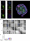 NSC23766 exposure resulted in growth inhibition of BPH patient-derived orga
