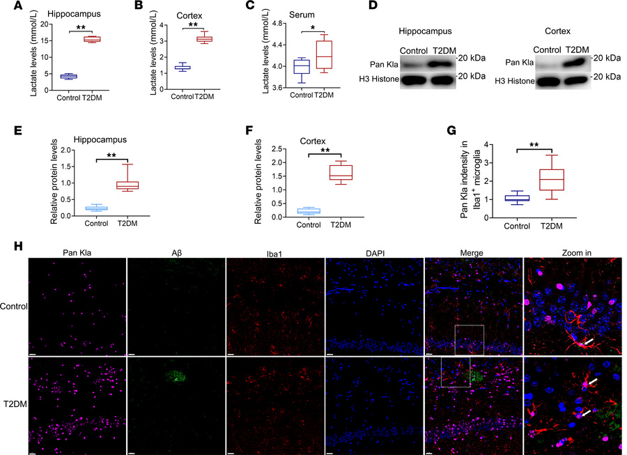 Lactate levels and Pan-Kla are increased in the cortex and the hippocamp...