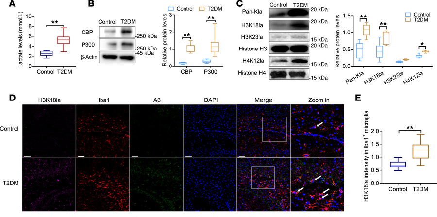 Elevated levels of H3K18 Kla can be observed in microglia within the hip...