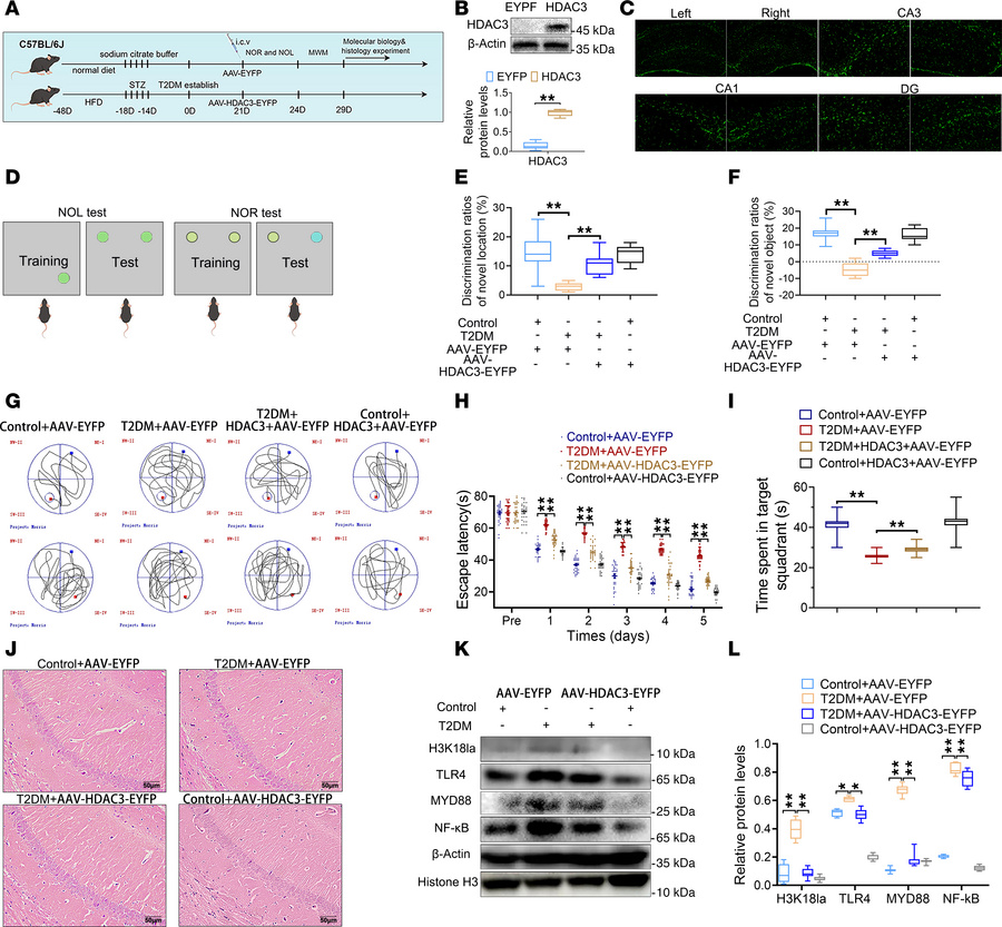 Inhibition of Kla of histone and H3K18 leads to TLR4/NF-κB suppression i...