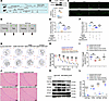 Inhibition of Kla of histone and H3K18 leads to TLR4/NF-κB suppression in v