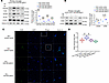 Inhibition of Kla of histone H3 at lysine 18 leads to TLR4/NF-κB suppressio