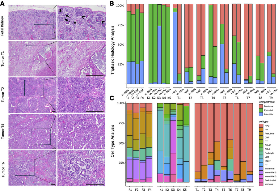 Histological examination of tumor samples correlates with cell types cap...