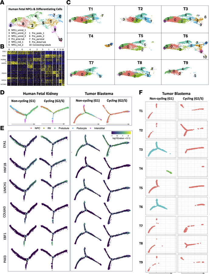 Trajectory analysis of Wilms tumor blastema shows intra- and intertumor ...