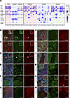 Blastemal, stromal, and epithelial components from favorable-histology Wilm