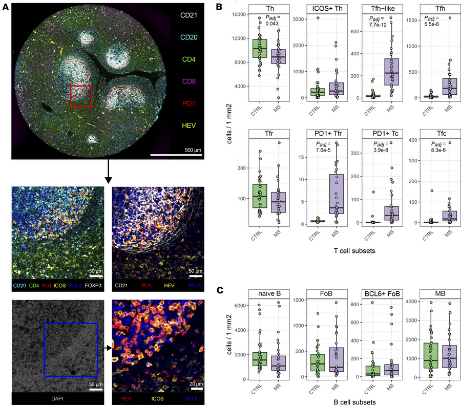 Tfh cells are increased in pwMS.
(A) mfIHC images with scale bars demons...