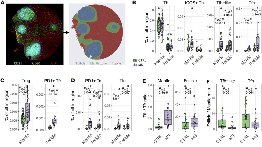 Expanded Tfh cells also accumulate in the mantle zone in pwMS.
(A) A mul...