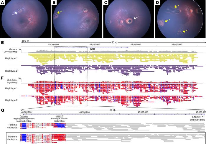Targeted long-read sequencing allows genomic and CpG methylome profiling...