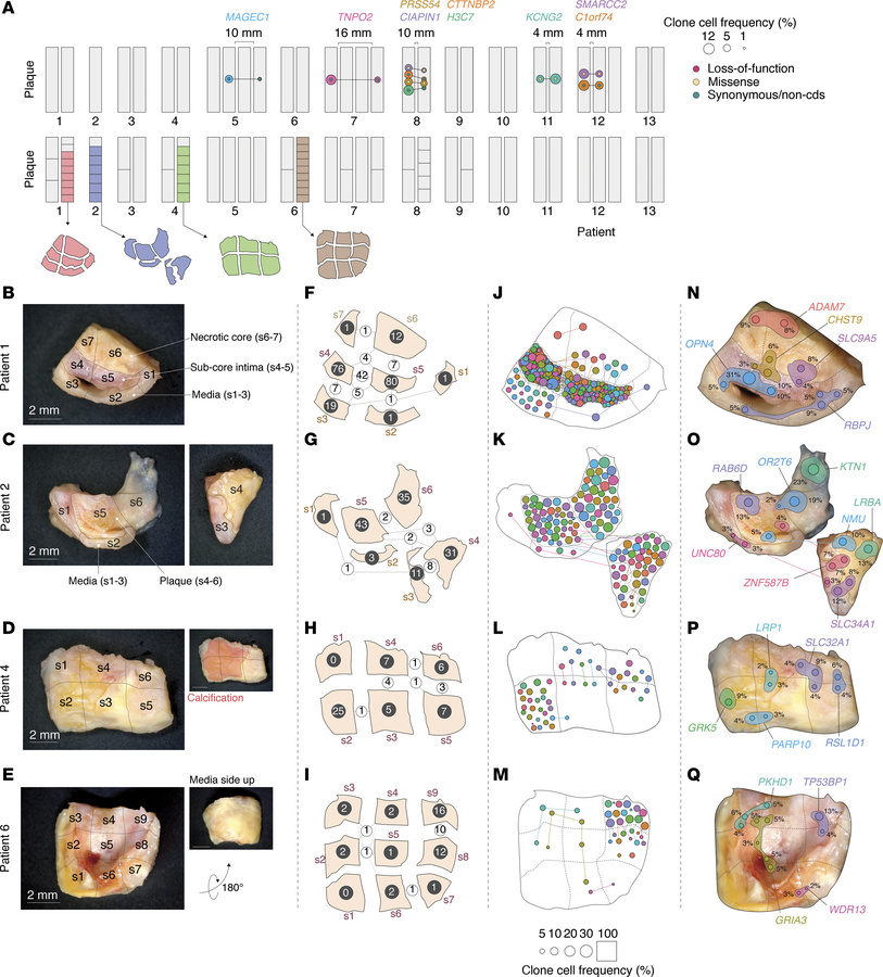 JCI Insight - Mutational landscape of atherosclerotic plaques reveals ...