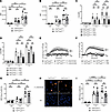 Csk is not involved in the regulation of neutrophil effector functions.