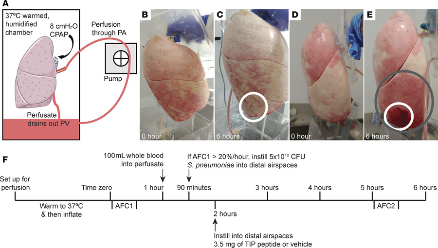 A translational model of bacterial pneumonia using the ex vivo–perfused ...