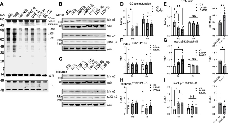 5b SCD inhibitor 5b normalizes GCase maturation,
αS T:M ratio and insolu...