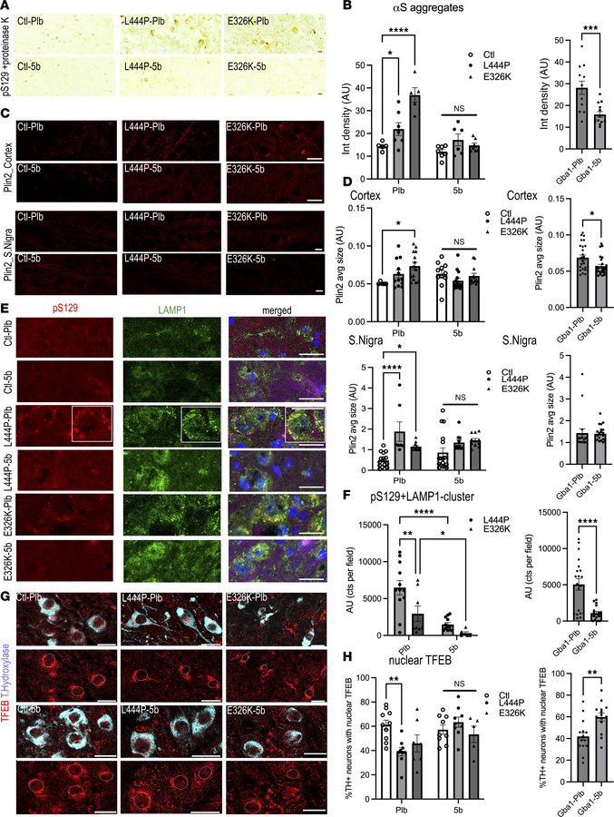 5b treatment reduces PK-resistant and vesicle/lipid-rich αS aggregates a...