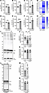 Monounsaturated fatty acids (C16:1 and C18:1) are increased in GBA1 L444P m