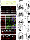 5b treatment reduces PK-resistant and vesicle/lipid-rich αS aggregates and