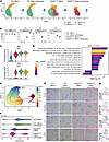 Oligodendrocyte maturation trajectory and cholesterol biosynthesis are affe