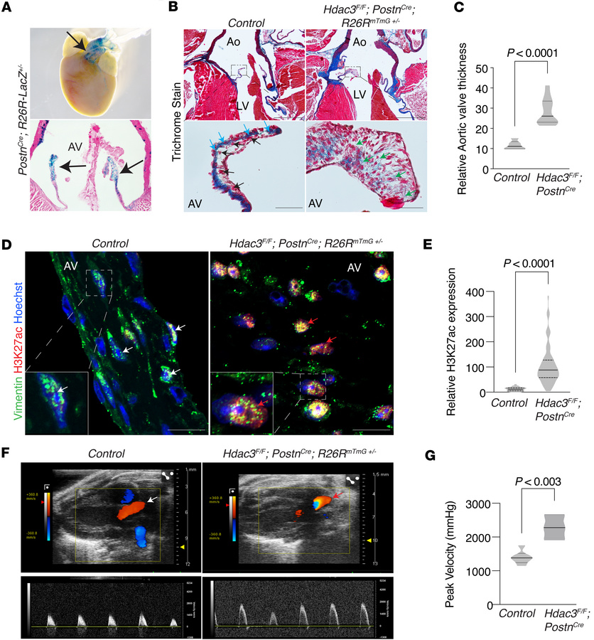 Genetic loss of Hdac3 in aortic valvular interstitial fibroblasts leads ...