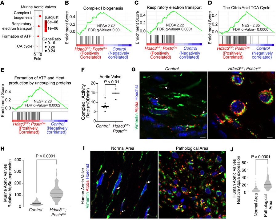 Loss of Hdac3 enhances mitochondrial biogenesis and activity in murine a...