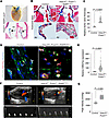 Genetic loss of Hdac3 in aortic valvular interstitial fibroblasts leads to