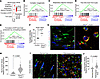 Loss of Hdac3 enhances mitochondrial biogenesis and activity in murine and