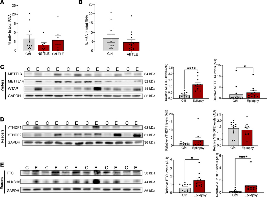 m6A regulators are disrupted in resected human TLE tissue compared with ...