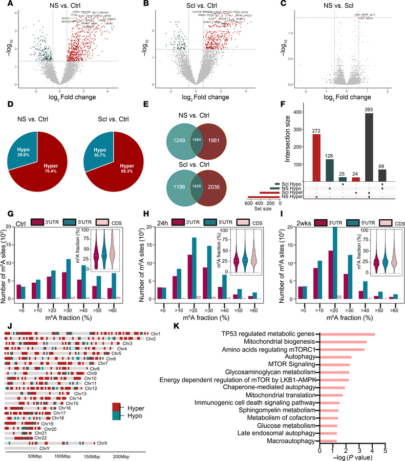 The m6A epitranscriptome is extensively disrupted in human TLE.
(A–C) Vo...