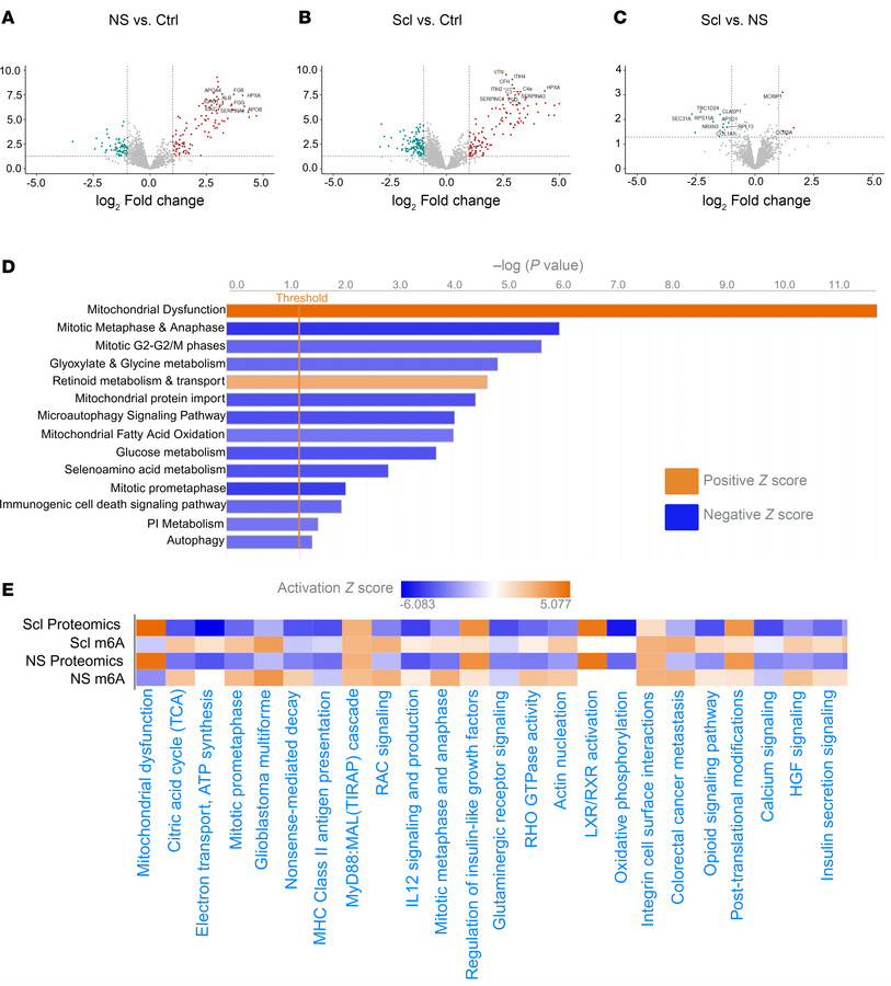 Proteomic analysis of human TLE reveals disruptions in metabolism and au...