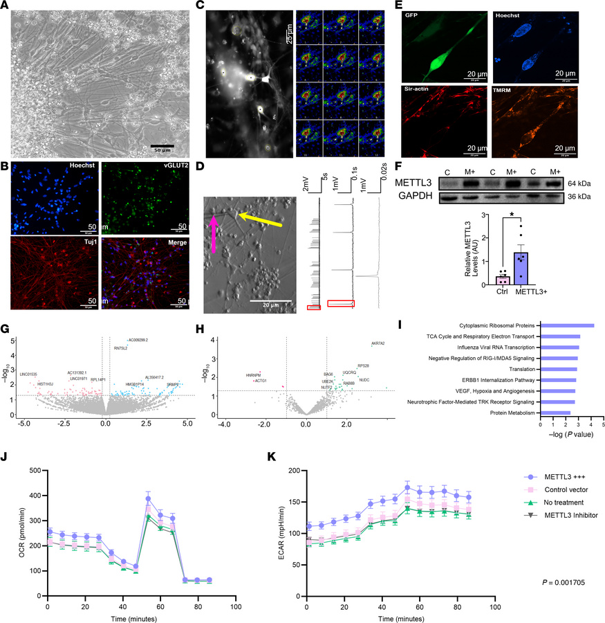 m6A regulates hIPSC-derived neuronal metabolism.
(A) Representative brig...