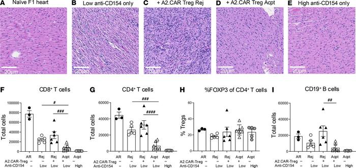 Graft acceptance in A2.CAR Treg recipients is associated with reduced ac...