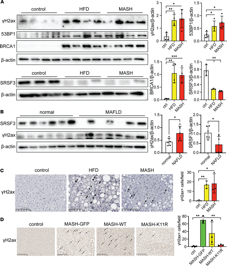 Preventing SRSF3 degradation reduces hepatocyte DNA damage in vivo.
(A) ...