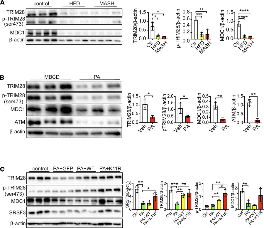 TRIM28 and MDC1 proteins are reduced by lipid overload.
(A) Immunoblots ...