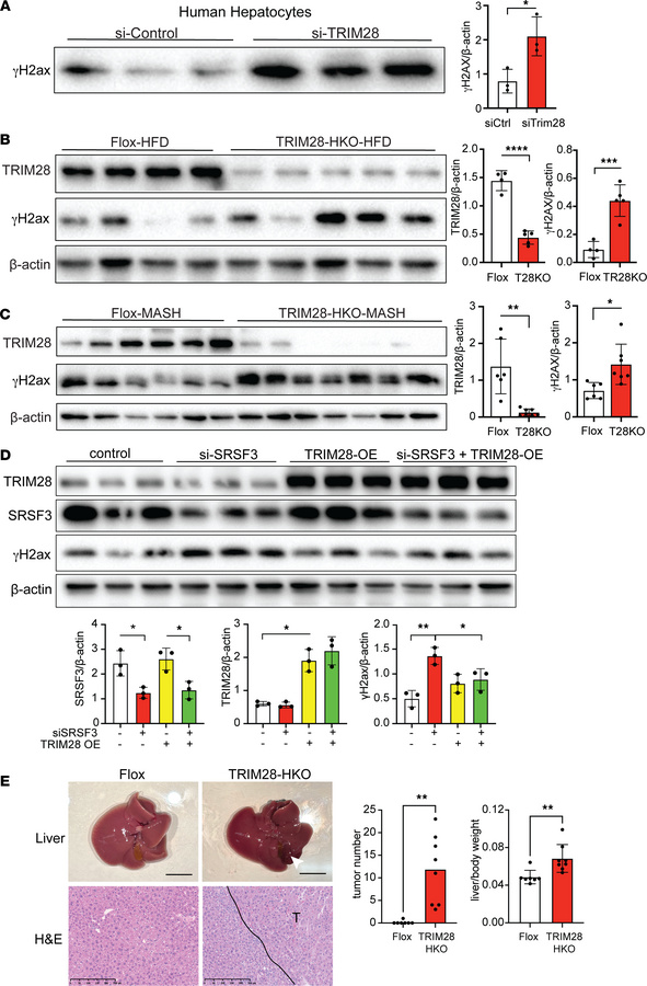 Loss of TRIM28 causes DNA damage.
(A) Immunoblots of γH2ax in primary hu...