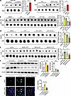 Knockdown of SRSF3 causes R-loop accumulation.