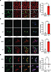 SRSF3 and TRIM28(pSer824) colocalize to sites of DNA damage.