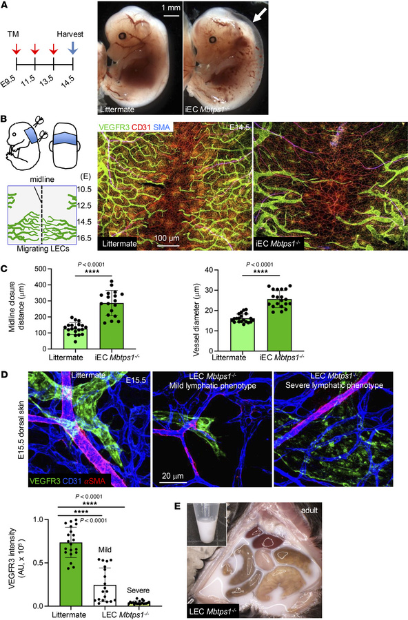 Mice lacking S1P in LECs show defective lymphatic phenotypes.
(A) The di...