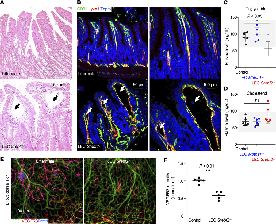 Mice with LEC-specific SREBP2 deletion show dilated lacteals.
(A) Repres...