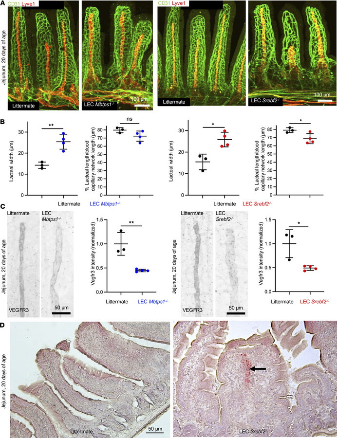 Mice with LEC-specific deletion of MBTPS1 or SREBP2 show dilated lacteal...
