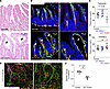 Mice with LEC-specific SREBP2 deletion show dilated lacteals.
