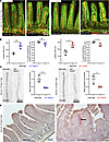 Mice with LEC-specific deletion of MBTPS1 or SREBP2 show dilated lacteals.