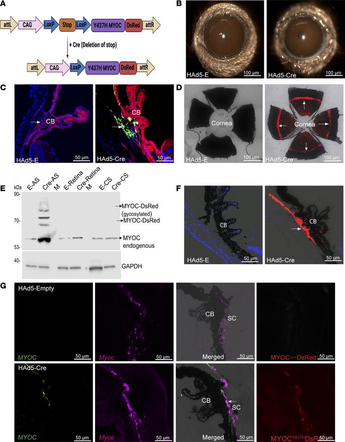 HAd5-Cre recombinase induces mutant MYOC in mouse TM.
(A) Tg.CreMYOCY437...