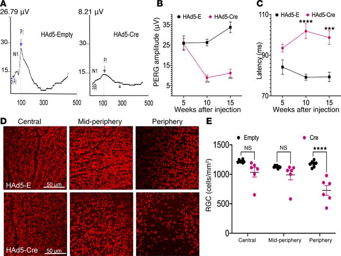 Sustained IOP elevation leads to functional and structural loss of RGCs ...