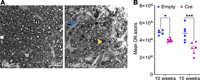 Sustained IOP elevation leads to optic nerve degeneration in Cre-injecte...