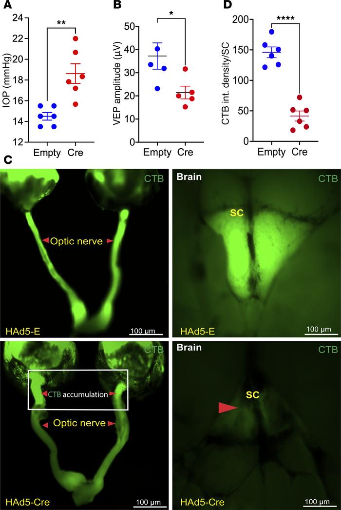 Anterograde transport deficits precede RGC degeneration in Tg.CreMYOCY43...
