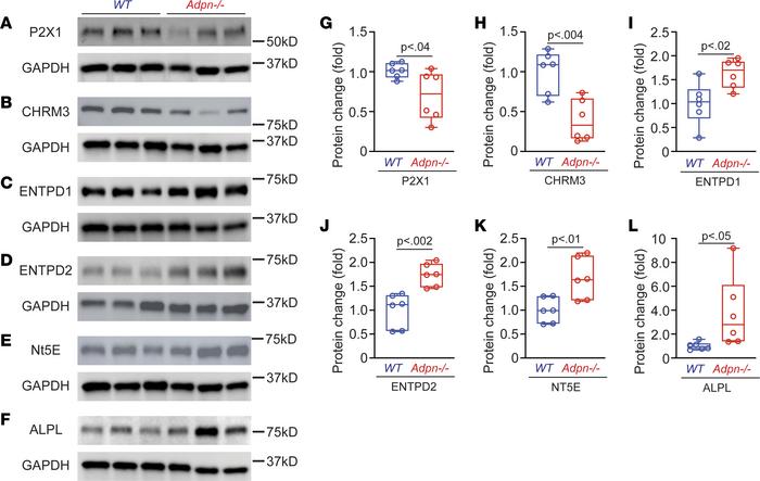 Changes in purinergic signaling components correlate with diminished BSM...