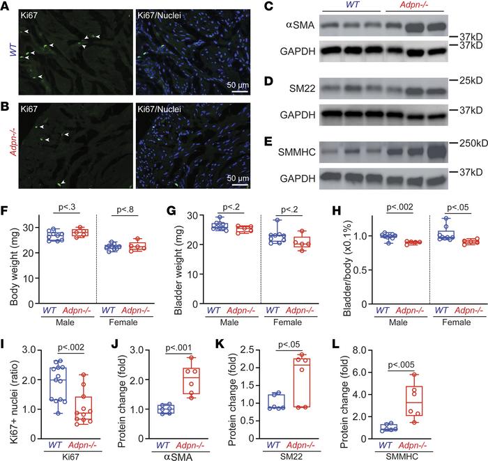 
Adpn–/– BSM cells exhibit altered proliferation and differentiation phe...