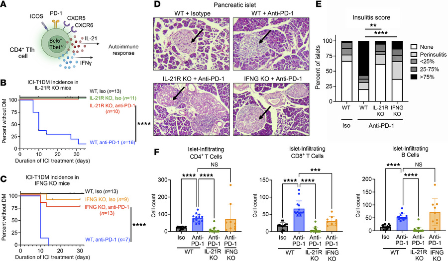 IL-21 and IFN-γ are key cytokine mediators of ICI-T1DM.
(A) Schematic of...