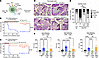 IL-21 and IFN-γ are key cytokine mediators of ICI-T1DM.
