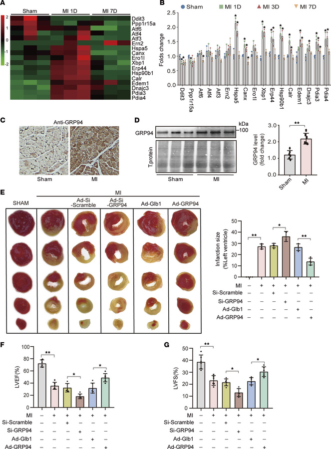 GRP94 attenuates cardiac dysfunction after MI.
(A) Heatmap showing DEGs ...