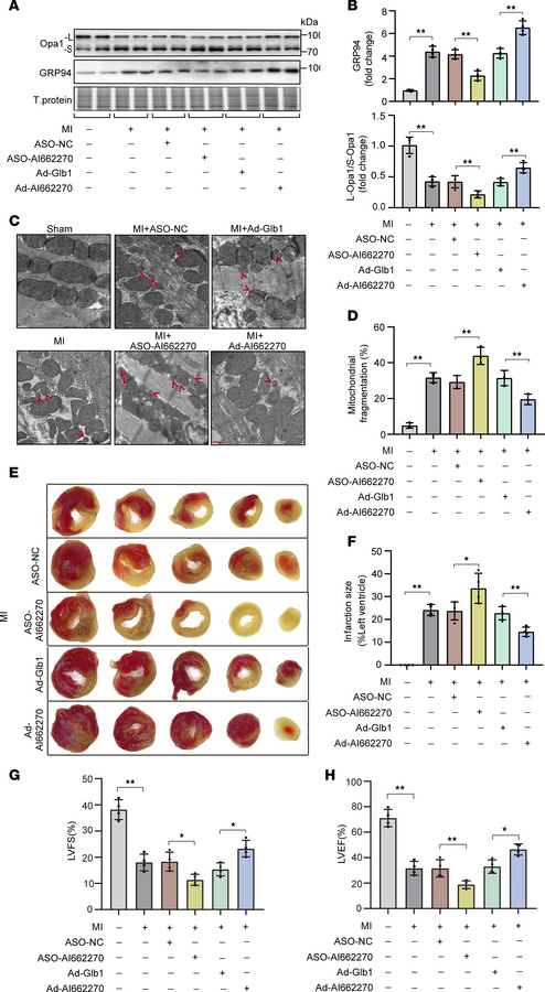 Lnc-AI662270 alleviates post-MI cardiac dysfunction via GRP94 and mitoch...