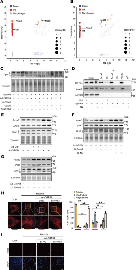 GRP94 interacts with Anxa2 to regulate the cleavage of Opa1.
(A and B) H...